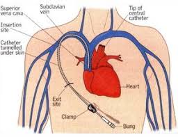 Pin By Asha Jacob On Nclex Questions And Nclex Tips Nclex Nurse Teaching Nursing Exam