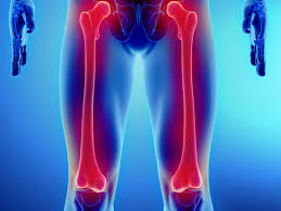 It does not include cancer that has spread to the bones from another body part. Pin On Cancer