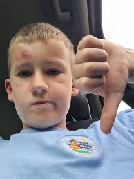 Not a good day today, a collision at School (playing football of course)  lead to a trip to the doctors with a heavy bump to the head and a grazed  leg. Luckily