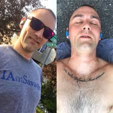 Hip replacement recovery and skateboarding progress