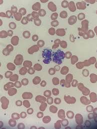 Image result for Intracellular Bacteria