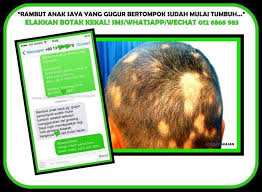 Kepala bangau ini botak dan di bagian bawahnya seperti terdapat rambut halus. Pin Pa Pelebat Rambut Paling Berkesan