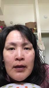 Chwechwe Pictures of Her in Hospital