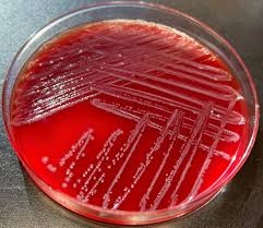 Image result for Shigella