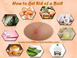 You'll also learn about the causes, symptoms, prevention tips and risk factors of boils. Instant Boil Relief How To Get Rid Of A Boil Overnight Treatment For Boils