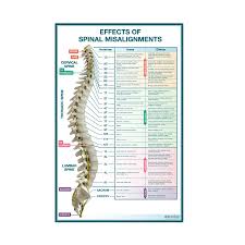 Effects Of Spinal Misalignments Sign Body Part Chart Removable Wall Graphic