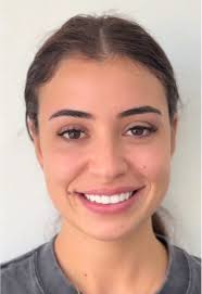 Composite Veneers: Artistry Behind Smile Design