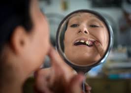 How bad teeth and lack of dental care can lead to poverty, discrimination