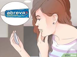 Cold sores are contagious until they crust over completely. How To Use Abreva 15 Steps With Pictures Wikihow