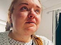 Fundraiser by Samuel Goodman : Raising awareness & funds for surgery to  save my wife.