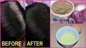 Change White Or Gray Hair To Black Shocking Remedy 100 Working Youtube Black And Grey Hair Thick Hair Remedies Remedy For White Hair