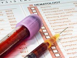 Hepatitis C Antibody Test Results And What To Expect