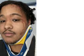 Fundraiser for Aidan Douglas by Jonas Tavarez : Aidan's Recovery Fund