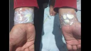 Hancurkan satu siung bawang putih untuk membuat pasta dan oleskan ke area baca juga: Viral Bawang Putih Ditempel Di Tangan Obati Sakit Gigi Ini Kata Dokter