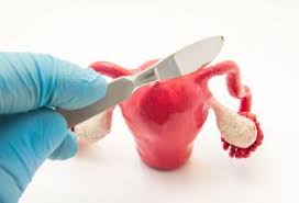 Pregnancy After Tubal Ligation Symptoms Complications More