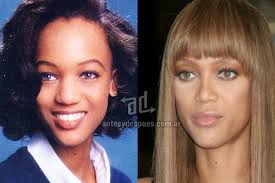 Blac Chyna Before Fame How To Job Whitney Houston Ranking De Famosos Que Han Recurrido A La Rinoplastia Listas En Nose Job Beyonce Nose Job Rhinoplasty Surgeon