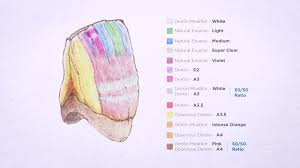 metal based crown bridge dentsply sirona