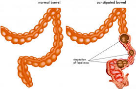 6 Relaxing Acupressure Points For Quick Constipation Relief