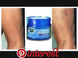 Pin On Treat Varicose Veins