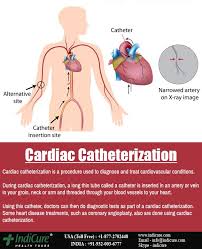 Cardiac Catheterization Is A Medical Procedure That Cardiologists Or Heart Specialists Cardiac Catheterization Cardiovascular Conditions Heart Catheterization