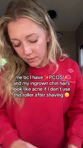 Shaving Down Sides of Chin