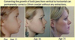 Janet Monge Archives