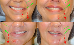 A crooked smile can cause dental problems that impact the health of your mouth. Our Facial Muscles And Their Functions Crystal Touch Bell S Palsy Clinic