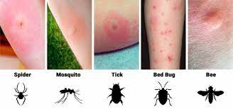 pin on health beauty