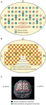 (ssi:pm) from sell (5) to underperform (4) with a price target of php1.20 (from php1.10). Frontiers Examination Of The Prefrontal Cortex Hemodynamic Responses To The Fist Edge Palm Task In Naive Subjects Using Functional Near Infrared Spectroscopy Human Neuroscience