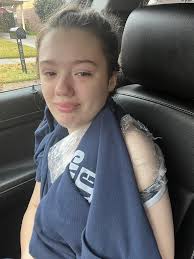 Update: thank you all for y'all's stories and words of encouragement, she  is currently being prepped for surgery in about 2 hours, the bone isn't  letting her wait. Same plan of resetting