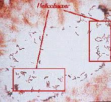 3 1 Cimetidin Magengeschwure Chemgapedia
