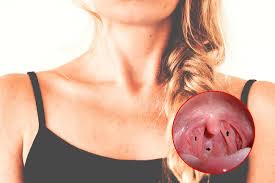 Other signs are mouth numbness, pain, bleeding, or weakness, as well as voice changes, ear ringing, and a sore throat that won't. Recognize Early Signs Of Throat Cancer For Prompt Treatment