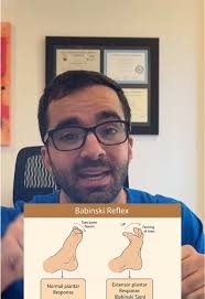 Image result for Babinski Reflex