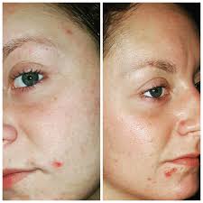 Benefit The Porefessional Pore Refining Face Primer Before And After Anti Aging Makeup The Power Of Makeup Anti Aging Makeup Power Of Makeup Aging Makeup