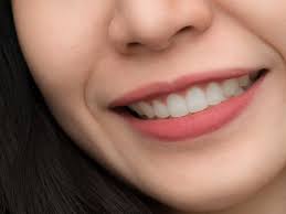 The end product is a very natural feel. How Long Does Tooth Bonding Last Chester County Family Dentistry