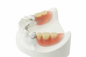 How much for upper dentures? Should You Get Partial Dentures Now Or Full Dentures