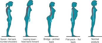 23.7 x 15.2 cm (9 5/16 x 6 in.) classification: A Sideways Glance Might Help Women Avoid Pain And Improve Their Life Say New Zealand Chiropractors Cromwell Chiropractic