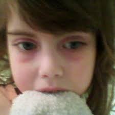 im a mother of a teenage boy and I can't get coles mum out my mind she's  going through every mothers nightmare my prayers are with her and her  family please keep