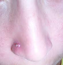 How To Get Rid Of The Bump On Your Nose Piercing Nose Piercing Body Piercings Piercing