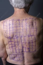 Image result for Patch Testing