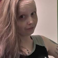 imagine getting kidnapped with a stuffy nose and they tape your mouth