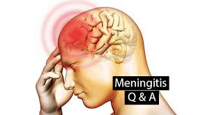 Meningitis is an infection of the meninges, the membranes that surround the brain and spinal cord. Meningitis Symptoms And Causes