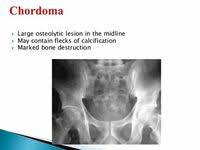 The Radiology Assistant Sclerotic Tumors In 2021 Tumor Radiology Gaucher S Disease