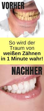 We did not find results for: So Bekommst Du Naturlich Weisse Zahne Zahne Aufhellen Hausmittel Weisse Zahne Weisse Zahne Hausmittel