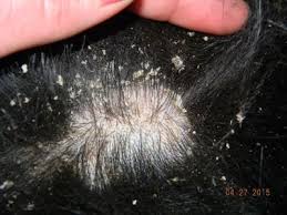 Hair loss, also known as alopecia, has various causes, but not all of which will also result in dandruff. Pin On Dog