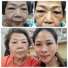 Has anyone had good results with this brand for their skin?