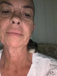 Chick with injured leg recovers with TLC