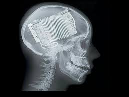 accordéon diatonique