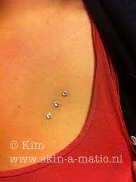 Some Healed Dermal Anchors