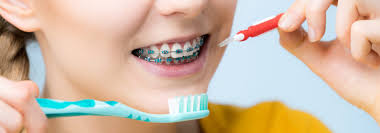 Do not turn on the brush until it is against the teeth. Braces Care How To Brush Teeth And Floss With Braces And Foods To Avoid
